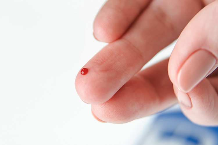 hba1c-test-Small-blood-sample-required