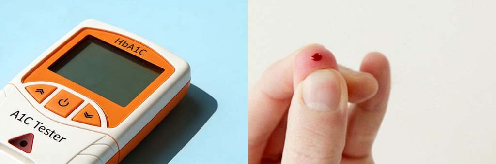 at-home-a1c-test